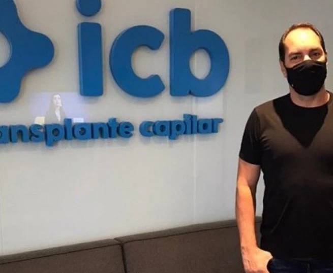 ICB Transplante Capilar recebe ex-jogador Edmundo