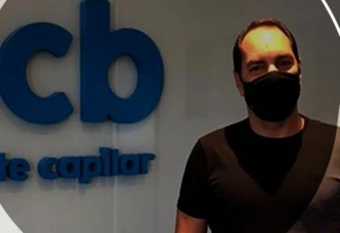 Jogador Edmundo realiza implante capilar no icb Transplante Capilar