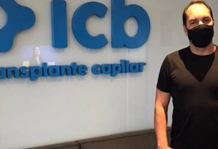 ICB Transplante Capilar recebe ex-jogador Edmundo
