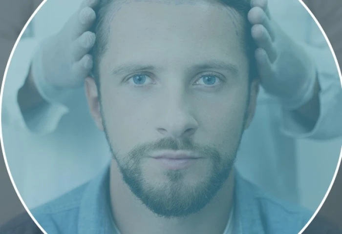 Tecnologia avançada: O segredo ICB para transplantes capilares naturais