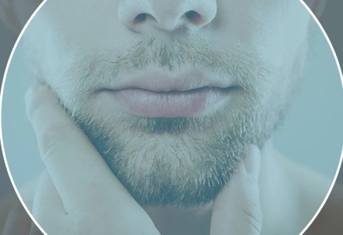 O que esperar do transplante de barba e por que escolher o ICB